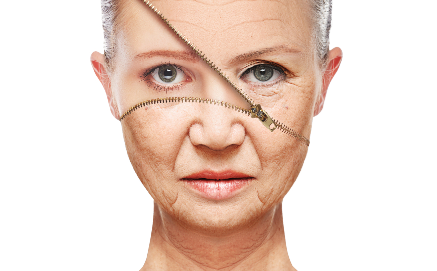 Skin Aging