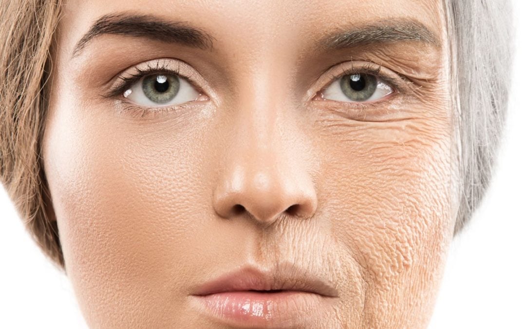 Skin Aging