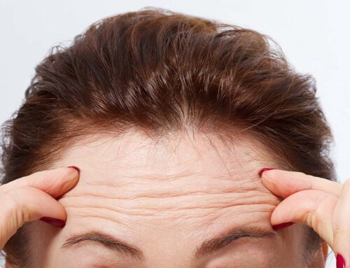 Prevent Forehead Wrinkles: 4 Effective Methods