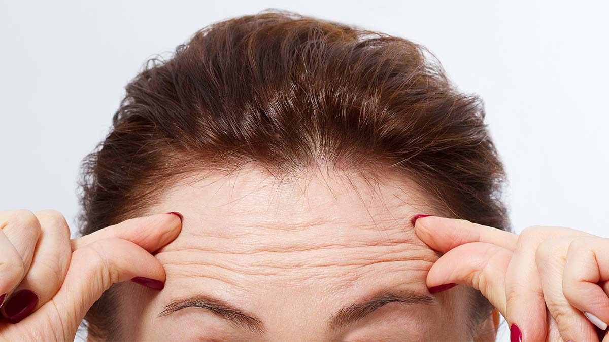 Prevent Forehead Wrinkles