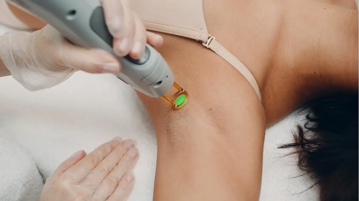 Preparing for Laser Hair Removal