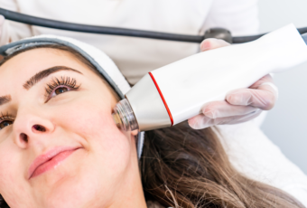 Science of RF Microneedling